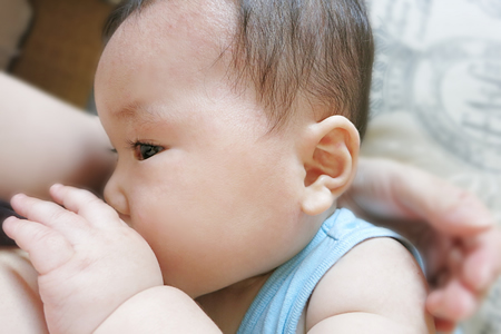 母乳性黄疸の症状と原因