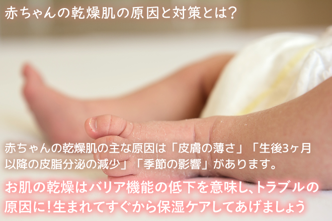 赤ちゃんの乾燥肌の原因とは？症状の特徴や対策について