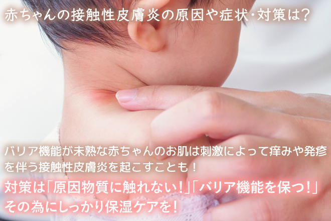 医師監修 赤ちゃんの接触性皮膚炎の原因や症状 対策について マンビーノ Mambino ドルチボーレ育児メディア