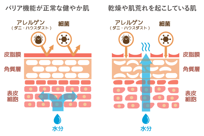 健やか肌と乾燥・肌荒れ肌との違い