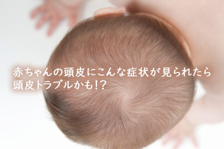 赤ちゃんの頭皮にこんな症状が見られたら頭皮トラブルかも！？