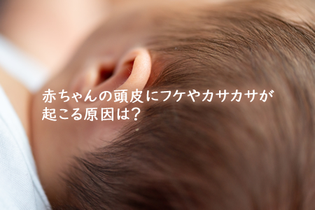 赤ちゃんの頭皮にフケやカサカサが起こる原因は？