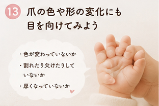 爪の色や形の変化にも目を向けてみよう
